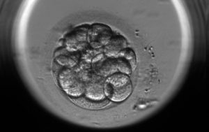 embryoscope2